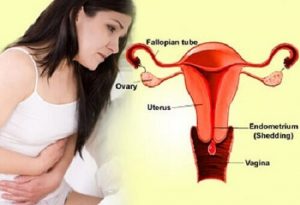 Biểu hiện polyp cổ tử cung ở nữ giới