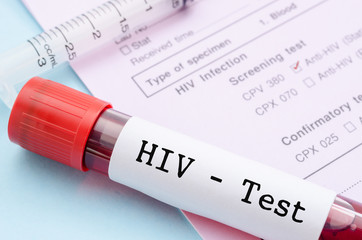HIV-xet-nghiem