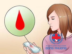 Chảy máu âm đạo cần lưu ý gì?
